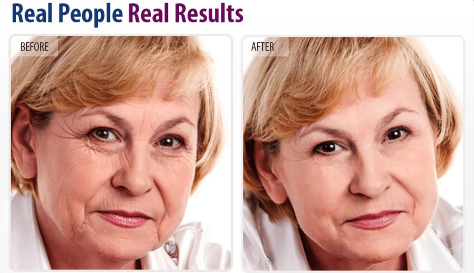 True Derma Serum Reviews
